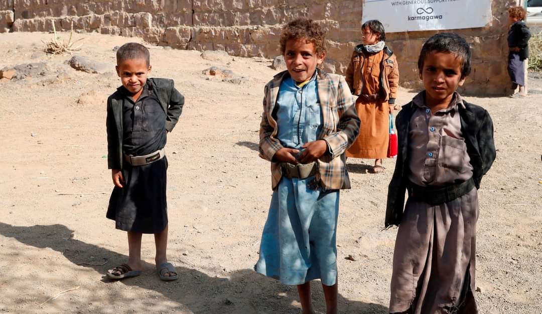 Desnutrición aguda en niños aumentará 22% en Yemen