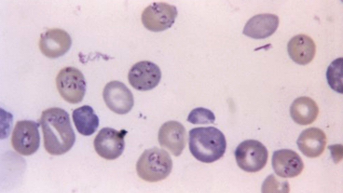 Auge de la “babesiosis” en EE.UU., transmitida por garrapatas, ataca a los glóbulos rojos en los humanos