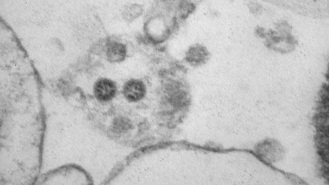 Publican una foto miscroscópica de la variante Ómicron del coronavirus
