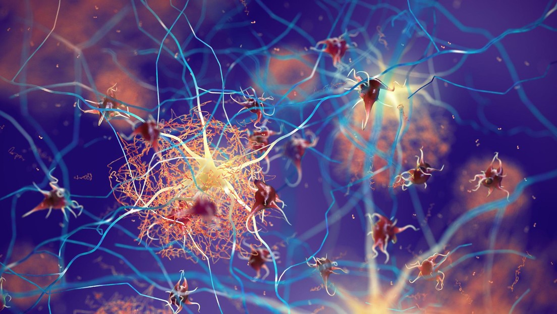 Descubren terapia para reducir el daño cerebral en enfermos de Alzheimer o con trastornos relacionados