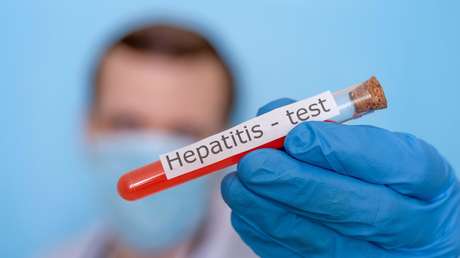 OMS reporta 650 casos de hepatitis infantil de origen desconocido en el mundo