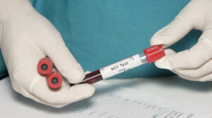 Una mujer en España se convierte en un caso único de curación funcional del VIH y abre nuevas vías de investigación