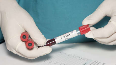 Una mujer en España se convierte en un caso único de curación funcional del VIH y abre nuevas vías de investigación