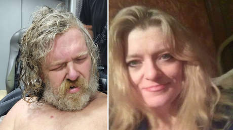 Una mujer se despierta tras pasar 2 años en coma e identifica a su hermano como su atacante