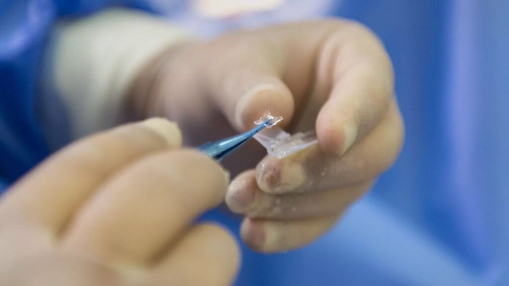 Moldavia registra un brote de la peste porcina africana