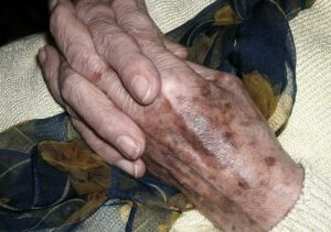 Adulto mayor perece al ser arrollado por un motociclista en Estelí