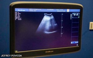 Hospital Fernando Velez Paíz realiza jornada de ultrasonidos