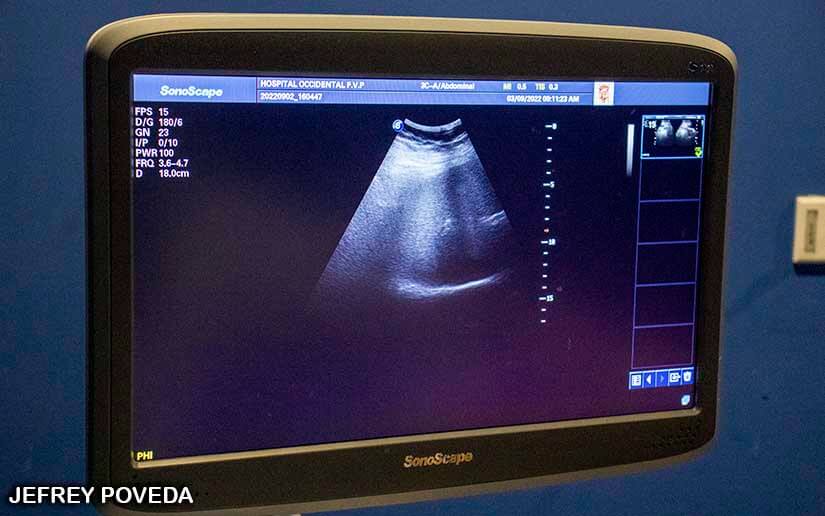 Hospital Fernando Velez Paíz realiza jornada de ultrasonidos