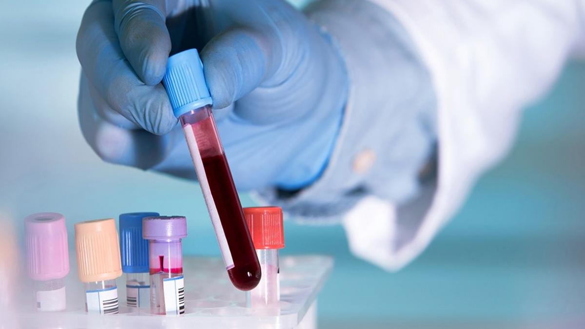 ¿Se puede beber agua antes de un análisis de sangre?