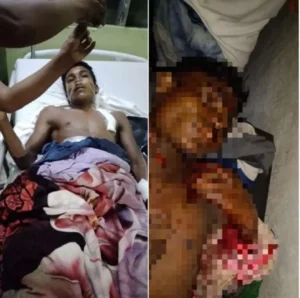 Por viejas rencillas 2 jóvenes se agarran a machetazos en Waspam