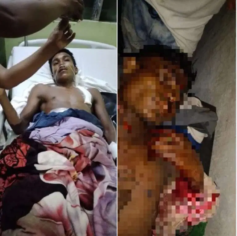 Por viejas rencillas 2 jóvenes se agarran a machetazos en Waspam