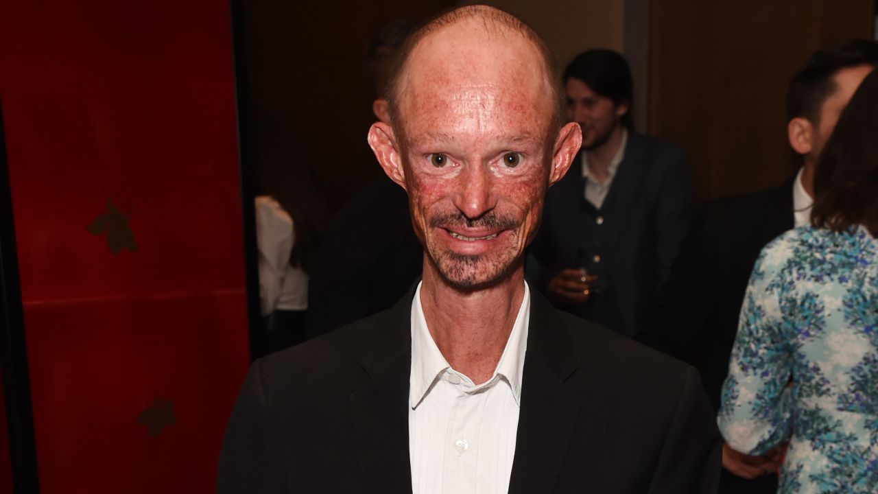 Muere a los 36 años Darren Kent, actor de la serie ‘Juego de Tronos’