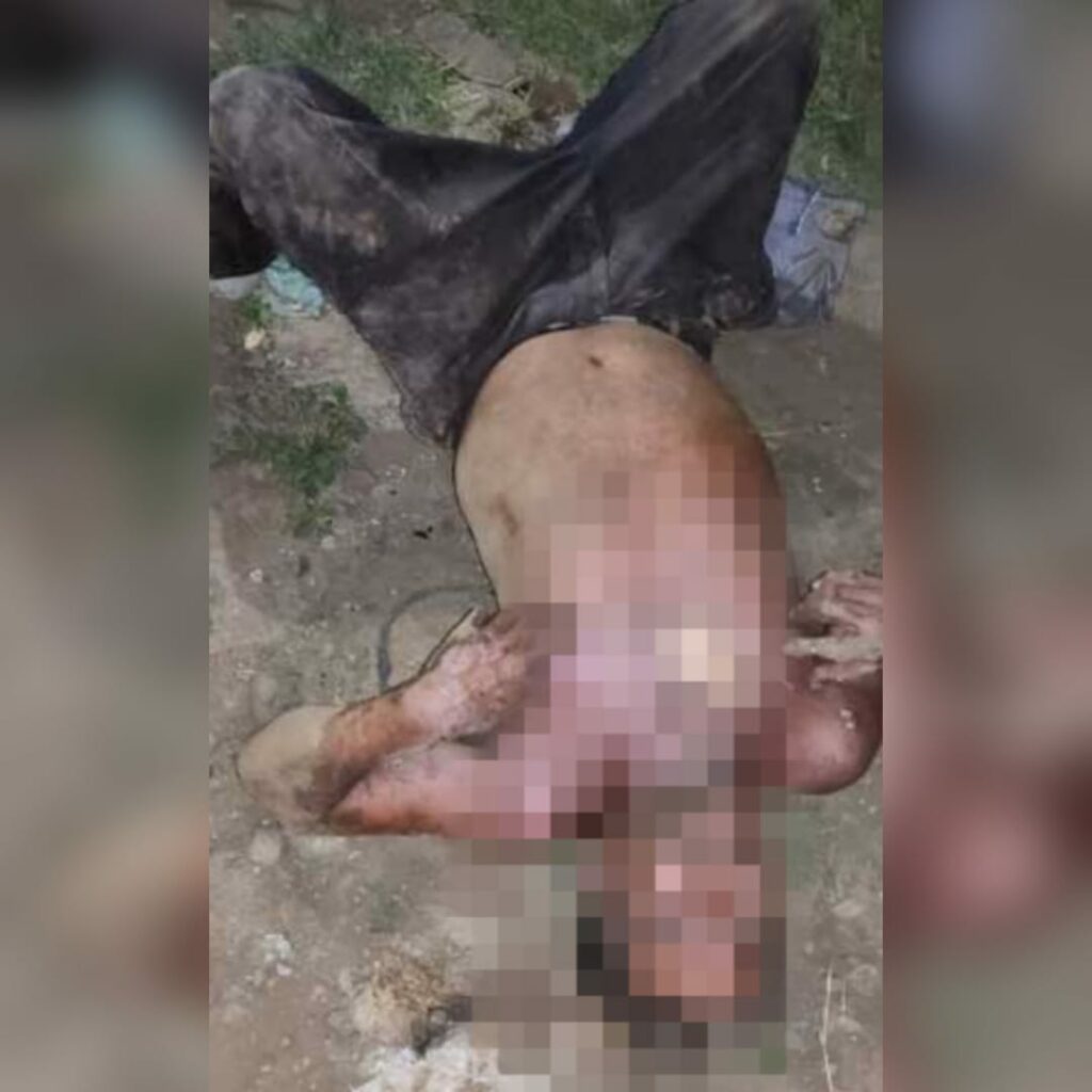 Padre e hijo terminan electrocutados al querer realizar conexión ilegal en Tipitapa