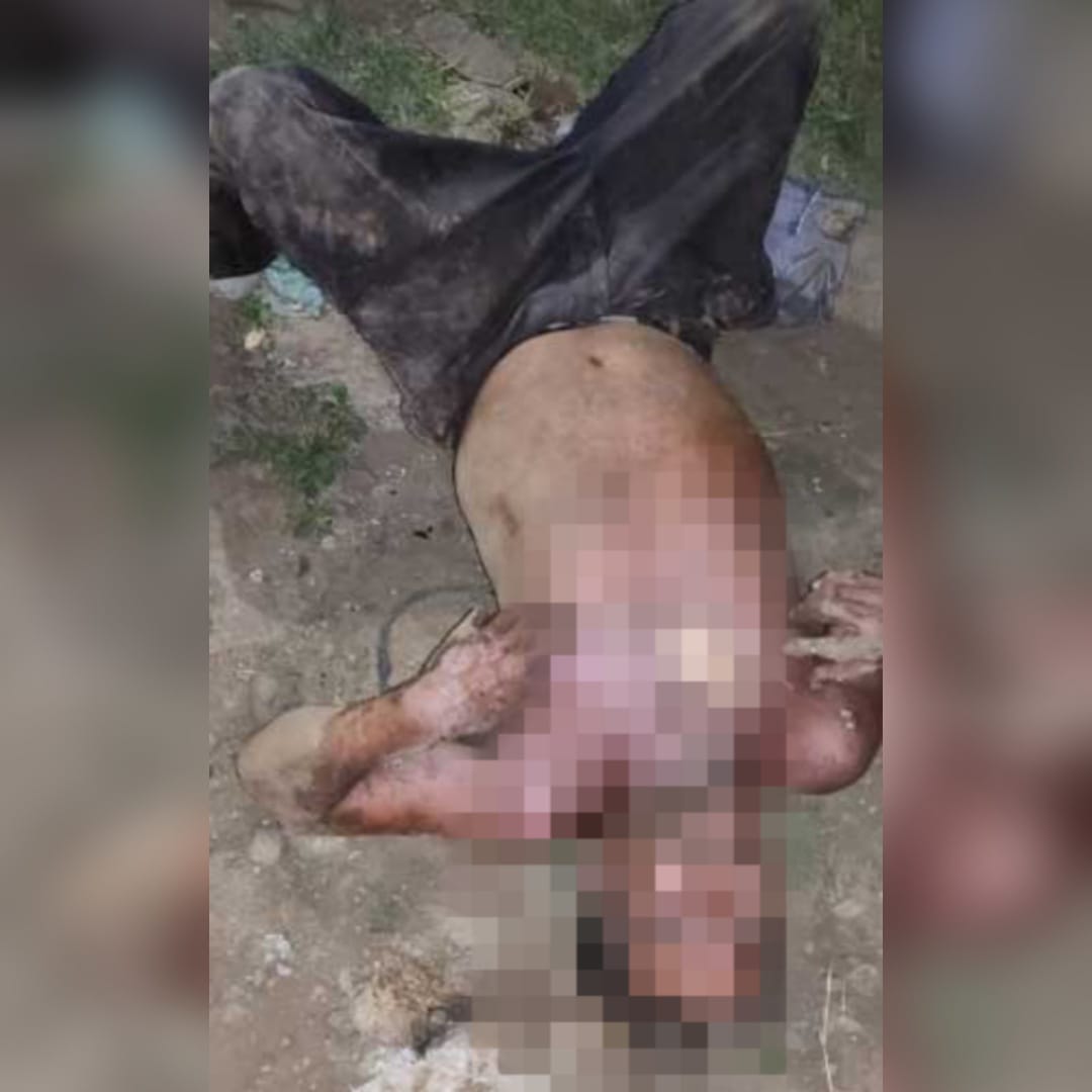 Padre e hijo terminan electrocutados al querer realizar conexión ilegal en Tipitapa