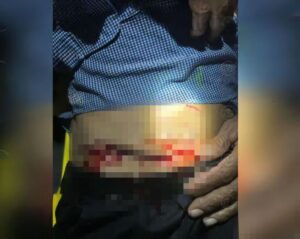 Rescatan a adulto mayor de las garras de un lagarto en el Lago Xolotlán