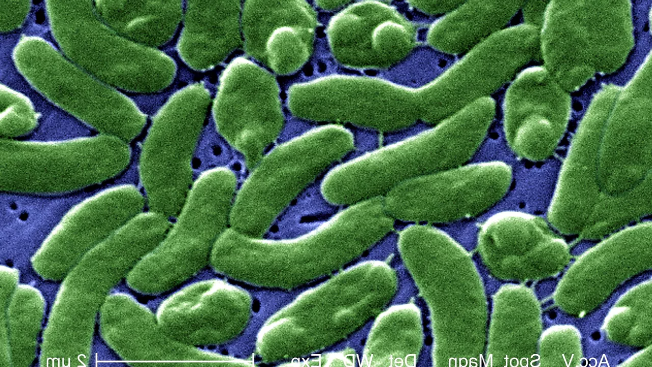 Con el marisco poco cocinado podrías ingerir bacterias carnívoras