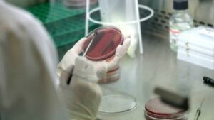 Brote de legionela deja al menos 19 muertos en Polonia