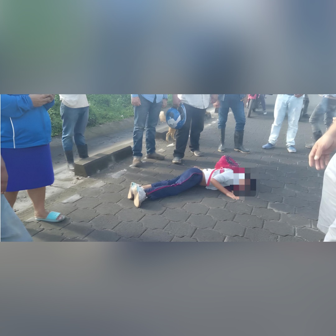 Niño queda grave tras ser arrollado por una motocicleta en Jinotega