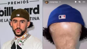 ¿Bad Bunny usó peluca en los Premios Billboards?
