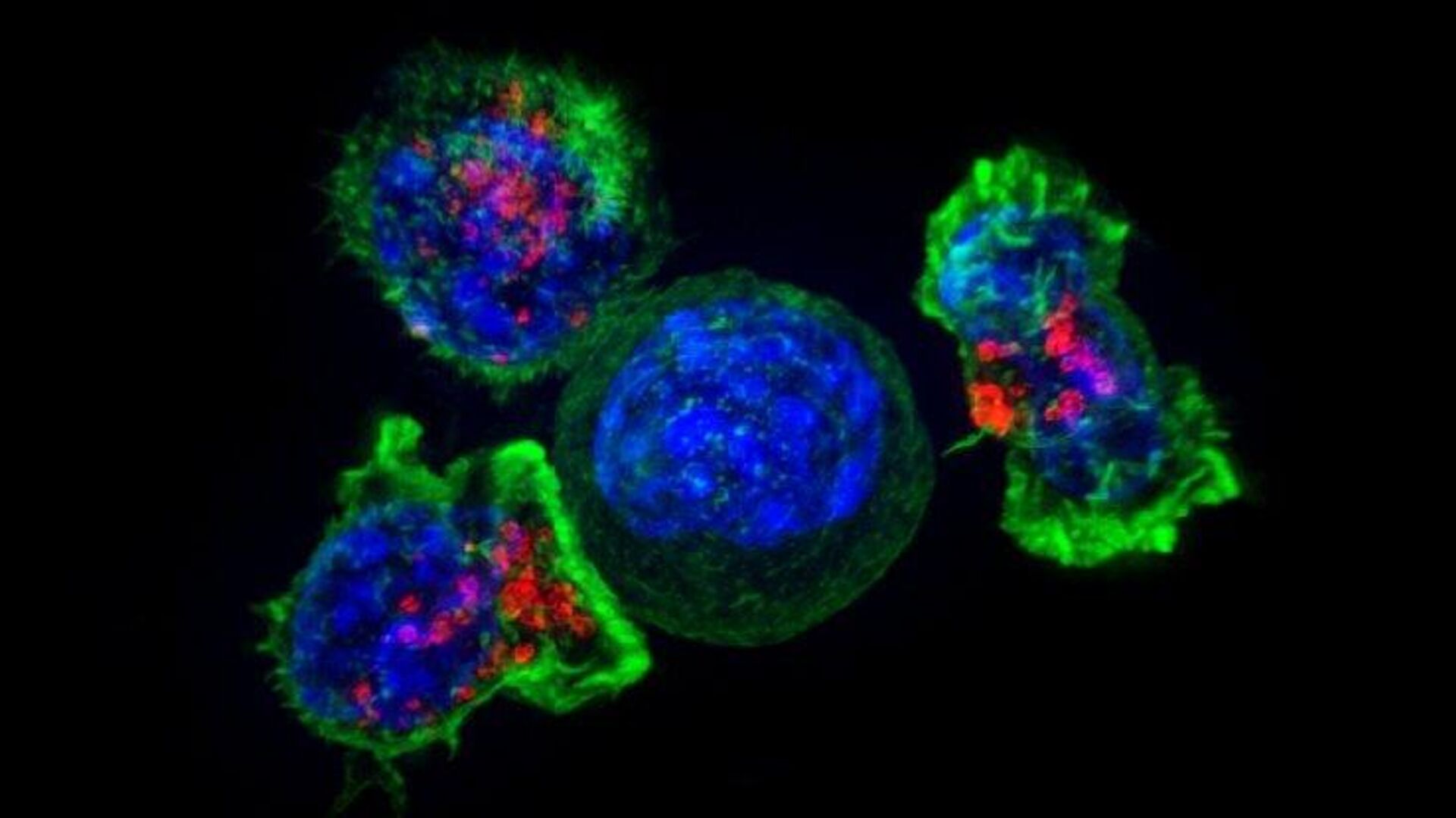 Un estudio revela las células cruciales para frenar el cáncer de intestino