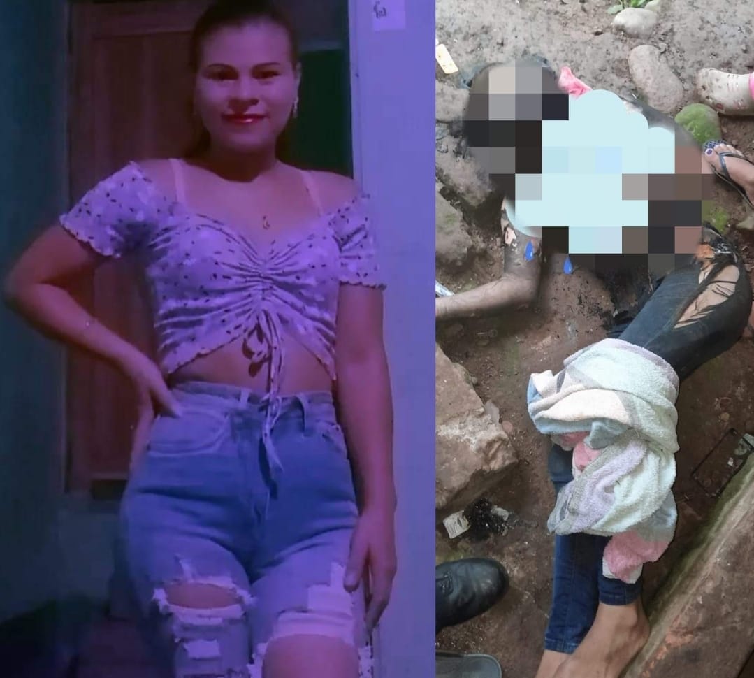 Fallece joven que fue quemada por su expareja en Waslala