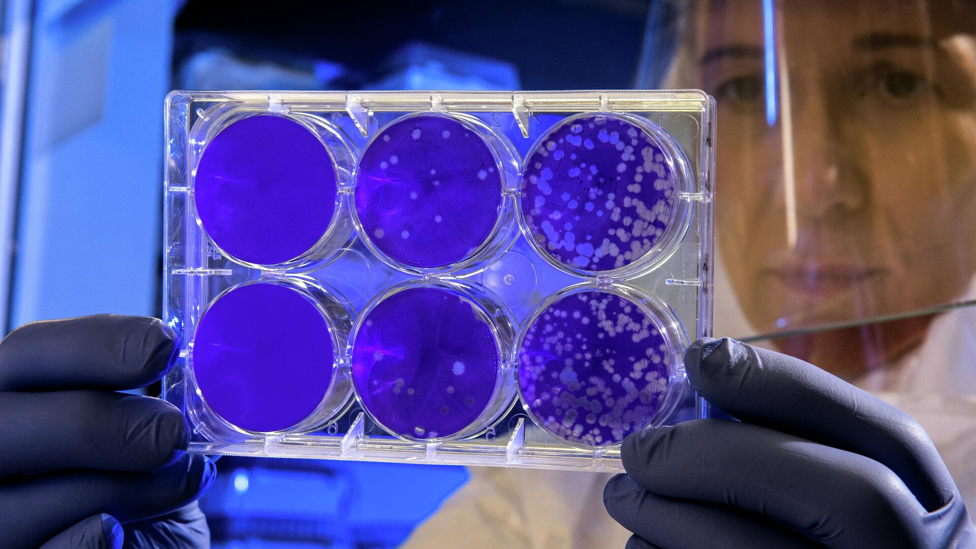 ¿Son contagiosos el cáncer y la diabetes? Científicos estudian por qué estos males se ‘trasmiten’