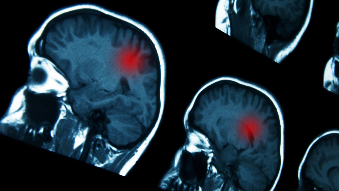 Vinculan ciertos fármacos hormonales con un mayor riesgo de tumores cerebrales