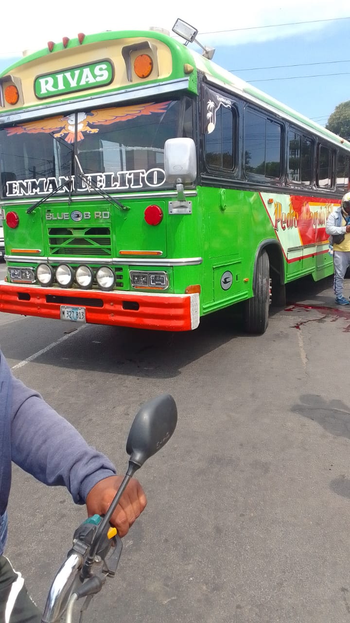 Llantas de bus le cercenan pierna a adulto mayor en el sector del mercado Roberto Huembes