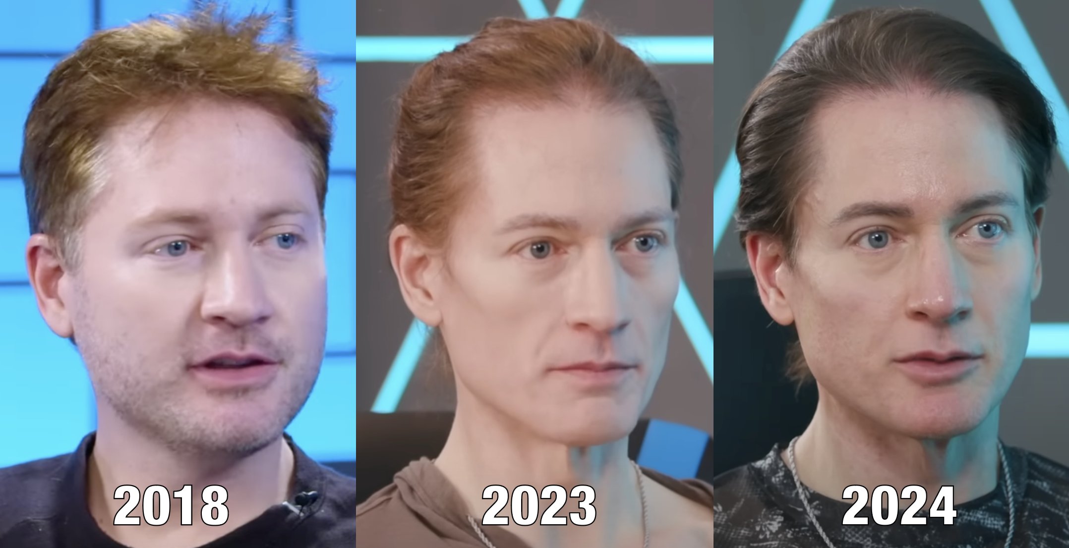 Biohacker’ multimillonario muestra el progreso de revertir su envejecimiento