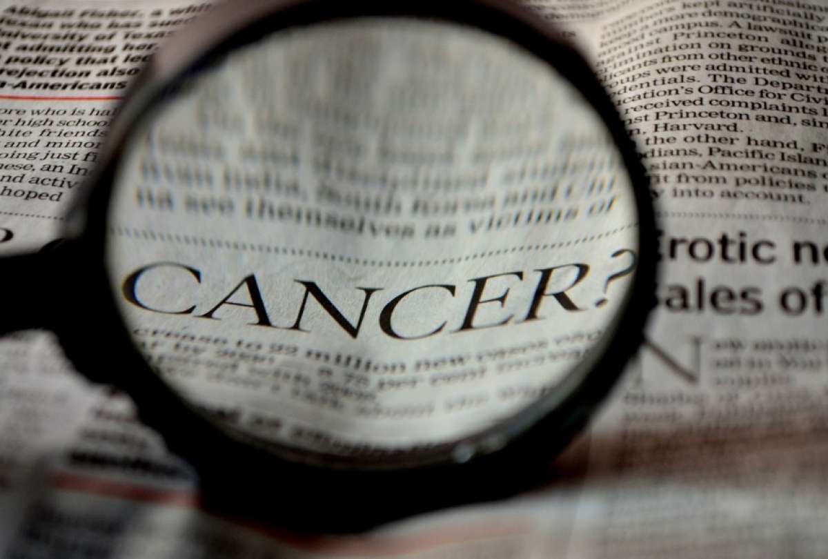 Casos de cáncer en el mundo podrían aumentar a 35 millones para 2050