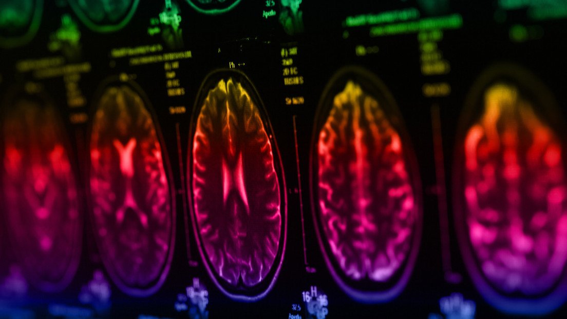 Médico lleva un año sin rastro de cáncer terminal tras someterse a su propia terapia