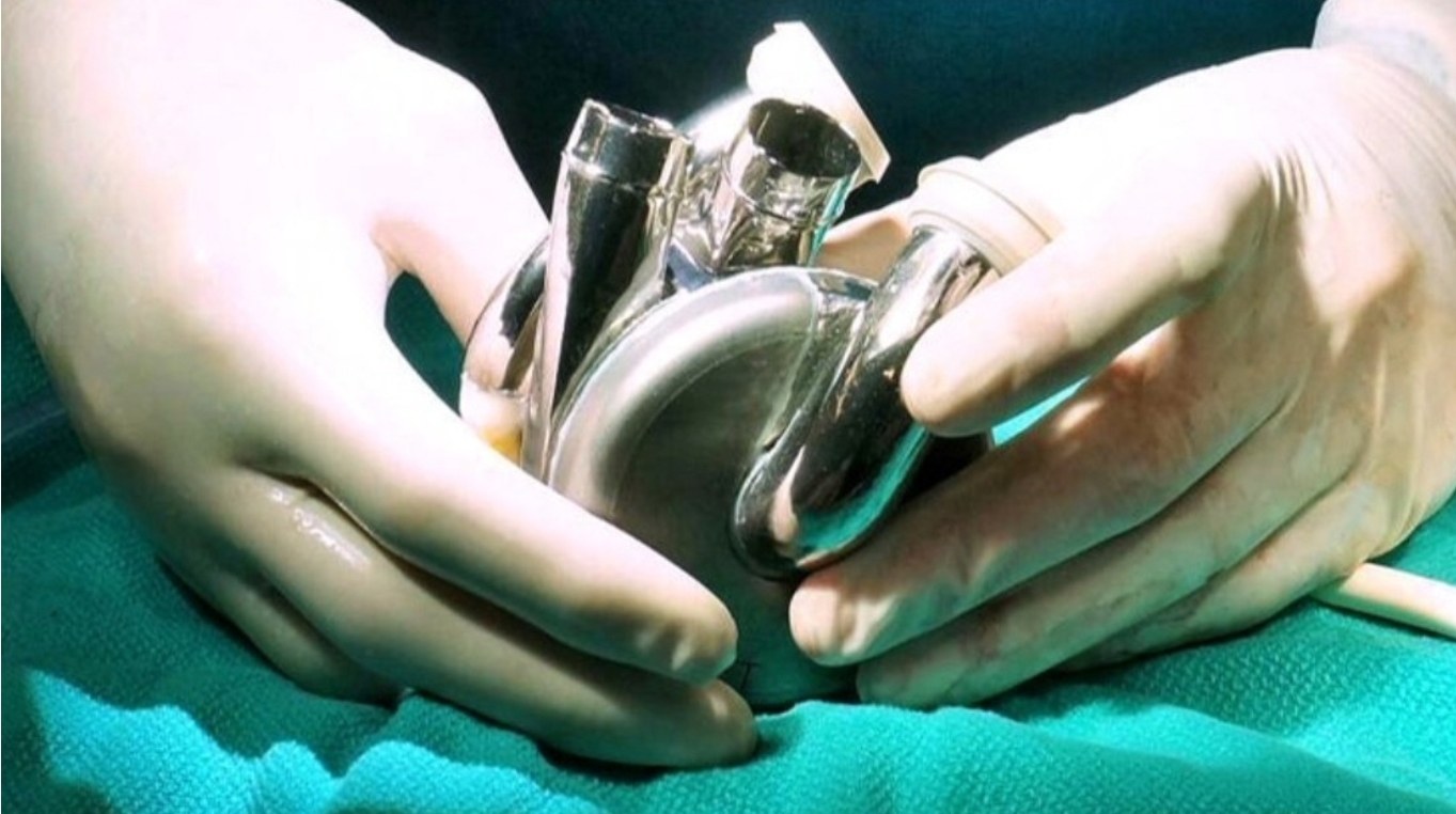 Implantan en un paciente el primer corazón artificial de larga duración del mundo