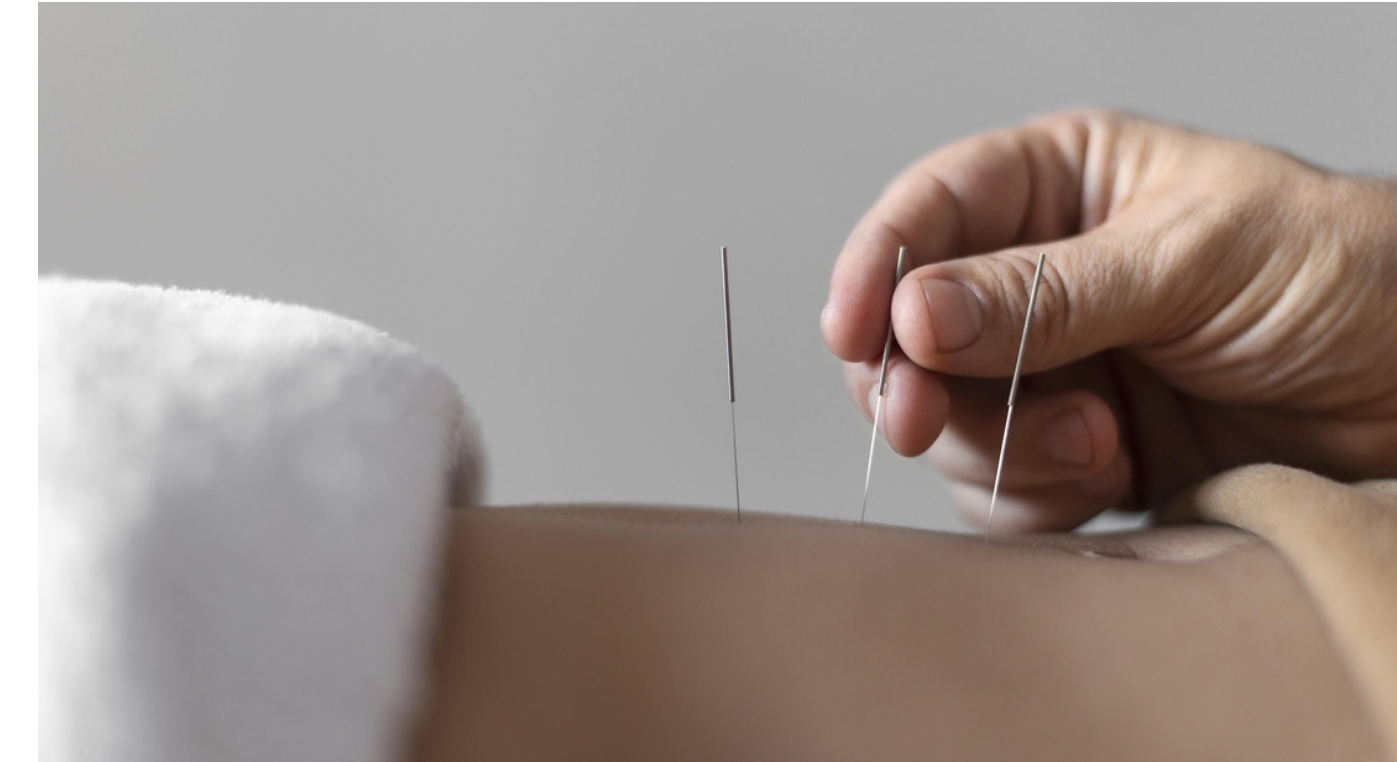 Una china que aprendió acupuntura viendo videos provoca insuficiencia cardíaca y mata a un paciente
