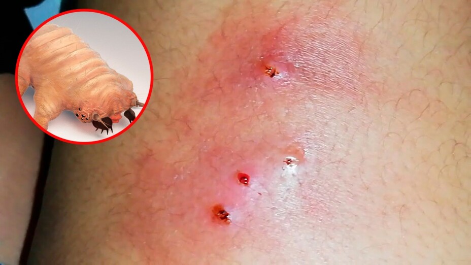 Humano-gusano-barrenador