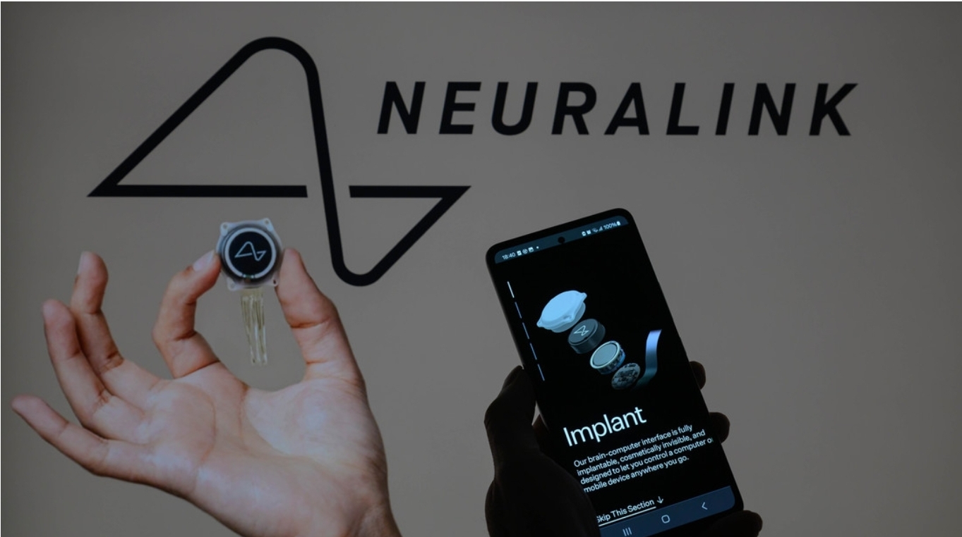 Neuralink probará si su chip cerebral puede controlar un brazo robótico