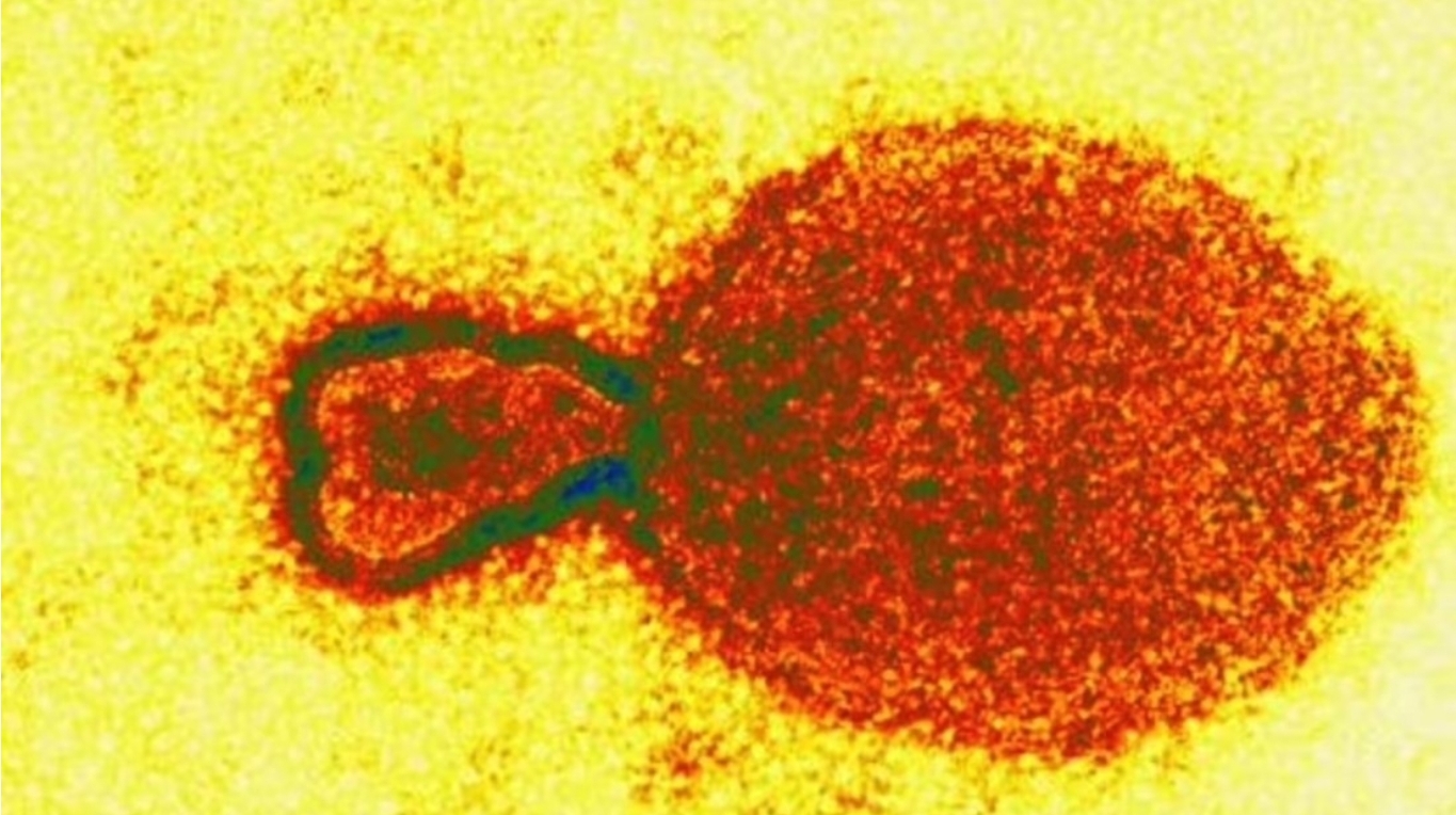 Desaparecen cientos de viales con virus mortales de un laboratorio en Australia