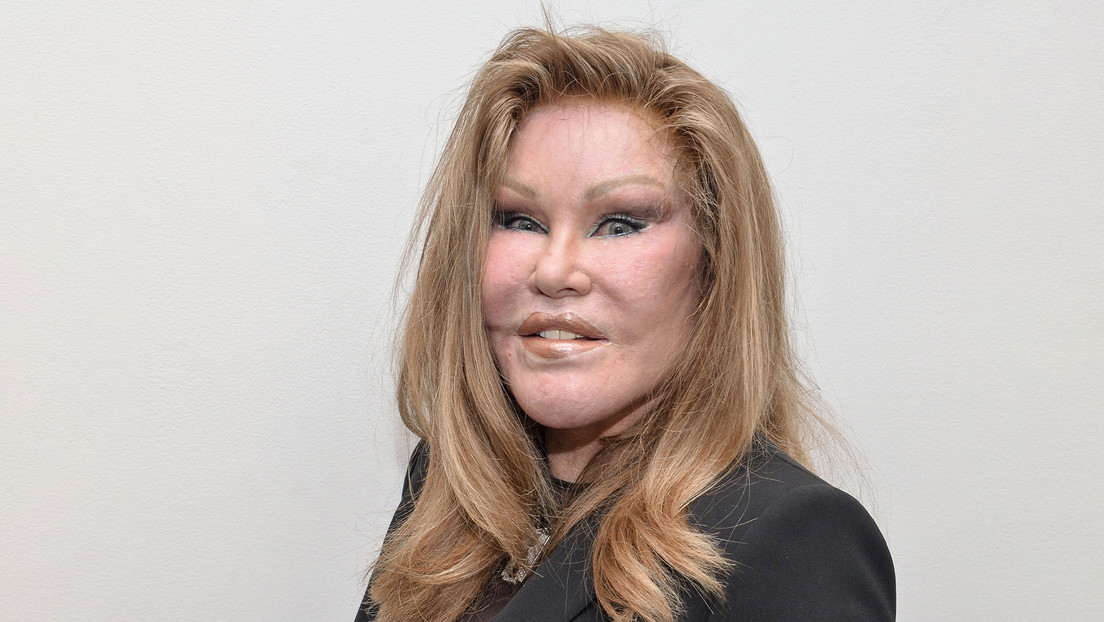 Fallece Jocelyn Wildenstein, ampliamente conocida como ‘Catwoman’
