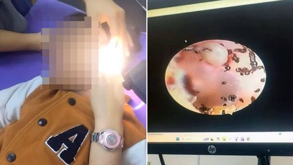 niña garrapatas oído