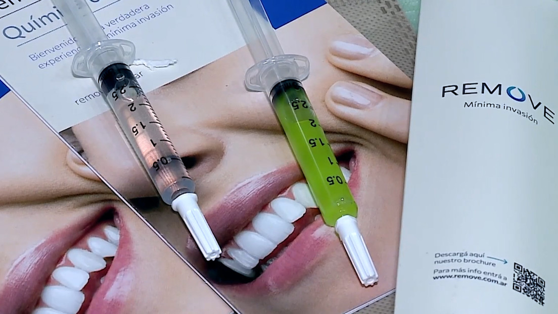 ¡No más dolor! Dentista argentino crea gel capaz de remover caries sin uso del torno