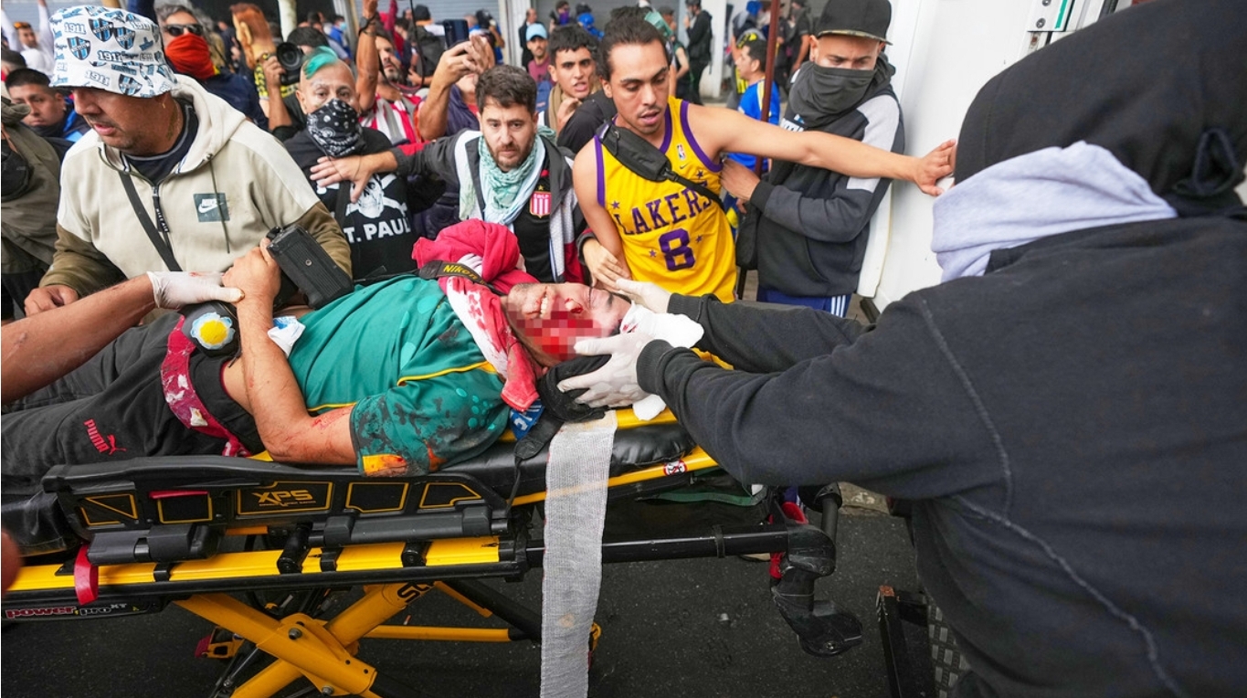 La Policía de Argentina fractura el cráneo a un fotoperiodista