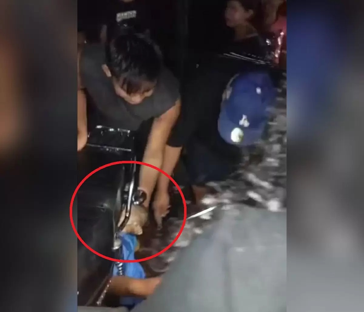 Niña pierde tres dedos de su pie tras un accidente de moto en Bilwi