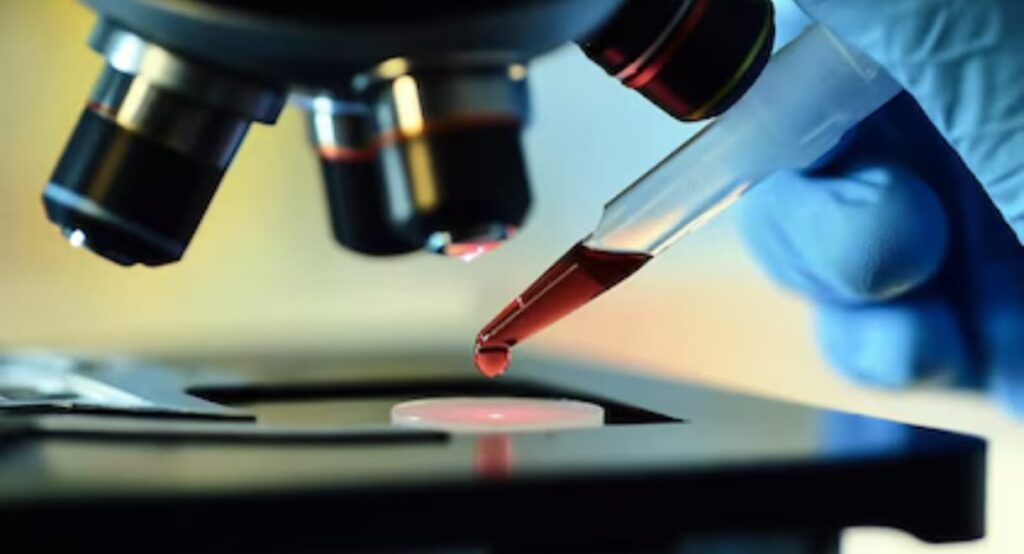 nuevo análisis de sangre