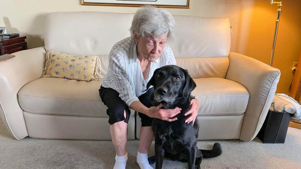Mujer recupera la vista gracias a una inusual cirugía de diente en ojo