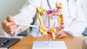 Estos simples hábitos ayudan a prevenir el cáncer de colon