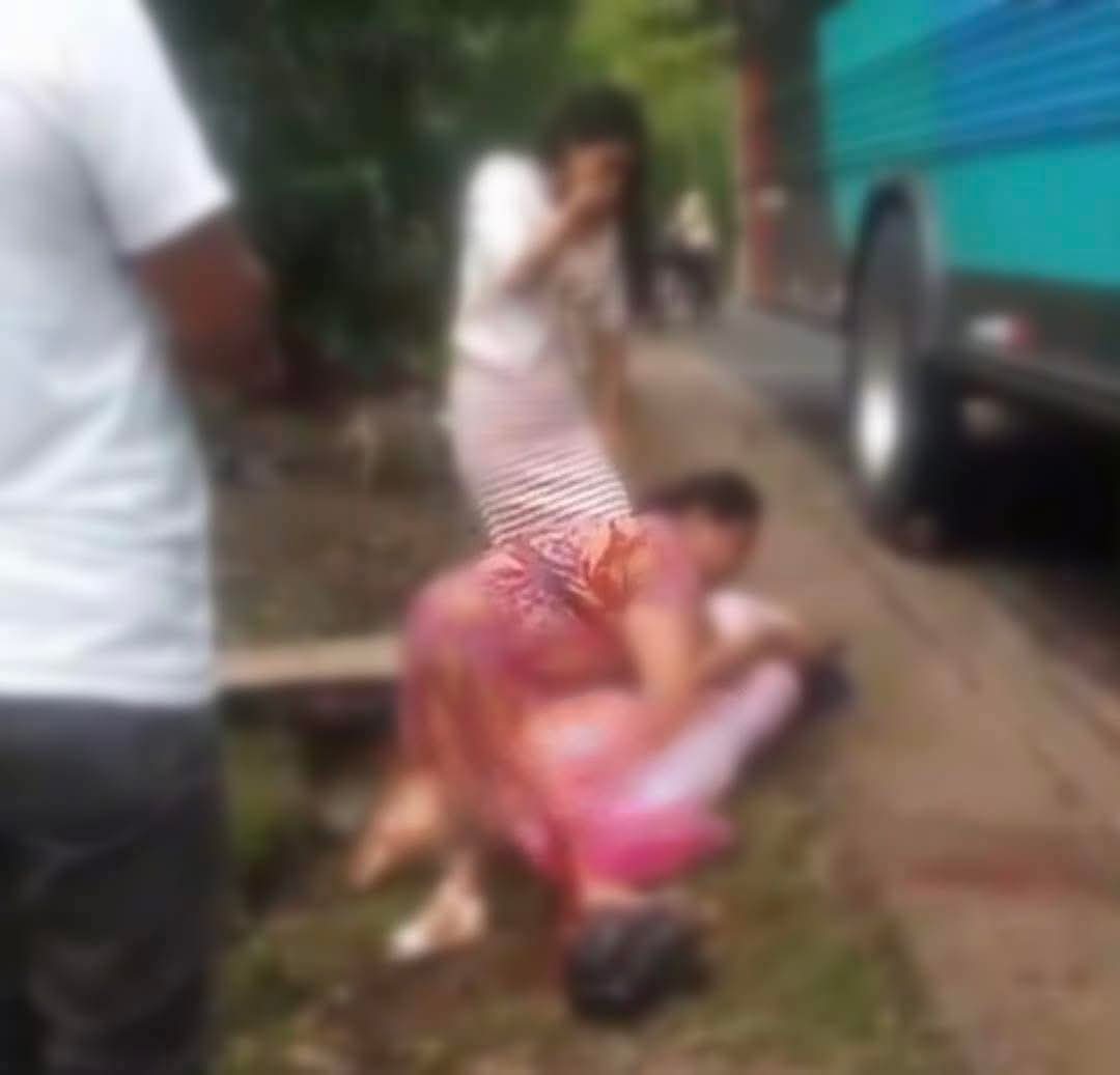 Niña de 9 años pierde su pie izquierdo tras pasarle un bus en Jinotega