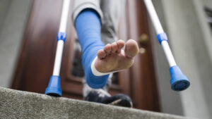 Obsesión por la altura: peligros de la polémica cirugía que alarga las piernas