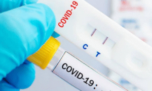 Casos del covid-19 mantiene tendencia a la baja en Nicaragua