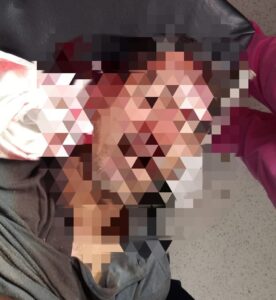 Hombre muere tras caer de un árbol en Mateare