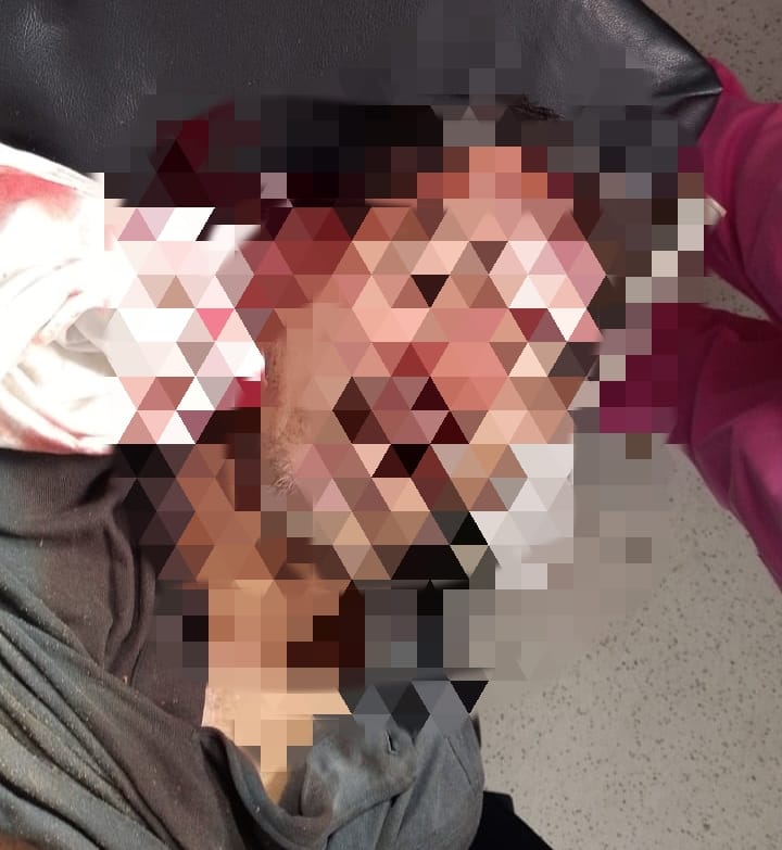 Hombre muere tras caer de un árbol en Mateare