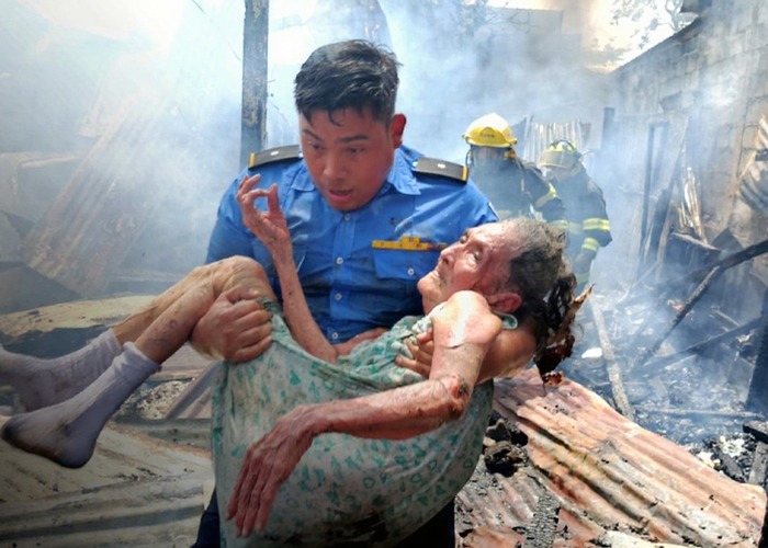 Madre acusa a hijo de provocar incendio donde resultó quemada